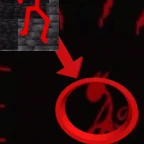 HATRED (Blocktales Chap 3) voice changer