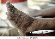 Maddness voice changer