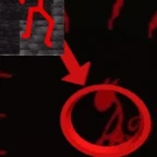 HATRED fan voice (Blocktales) voice changer